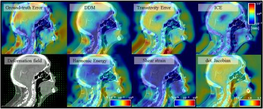 Simulated ground truth deformation error, including the estimated errors such as the DDM and Harmonic Energy. 